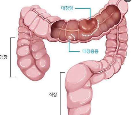 1379-건강 4 사진 2.png