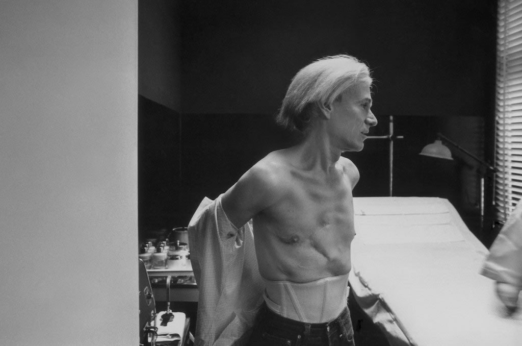 Warhol's injuries after being shot by Valerie Solanos.jpg